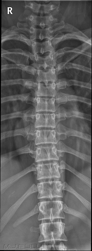 X-RAY AP VIEW DORSAL SPINE